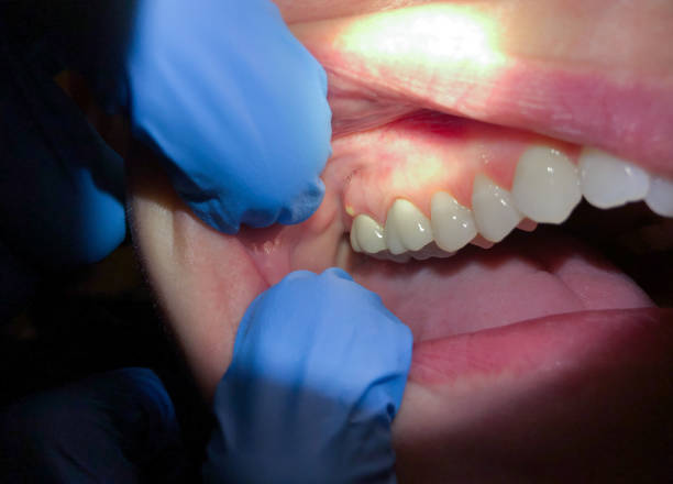 Best After-Hours Emergency Dentist in Trainer, PA