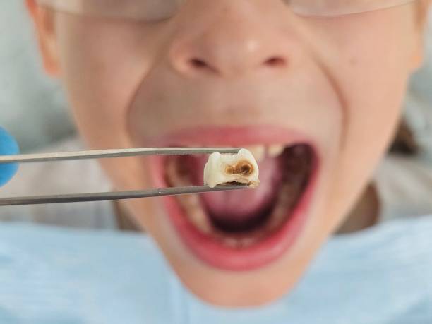 Best Same-Day Emergency Dentist in Trainer, PA
